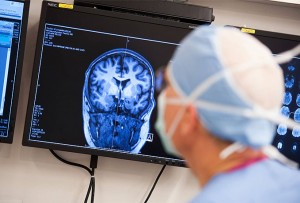 mozak-doktor-epilepsija